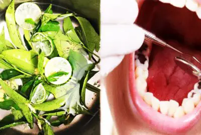 Dùng nước lá chanh đun đặc: Cách duy nhất trị dứt sâu răng, hôi miệng lâu năm và viêm lợi