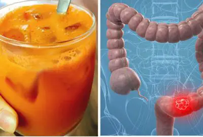 6 thức uống ‘thải độc’ đại tràng tự nhiên: Uống vào hết lo viêm loét hay bệnh ác tính