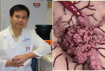 Tiến sĩ Việt nổi danh thế giới nhắc ‘dân mình’ bớt ăn dưa cà muối, ngủ đủ 8h để chặn ung thư